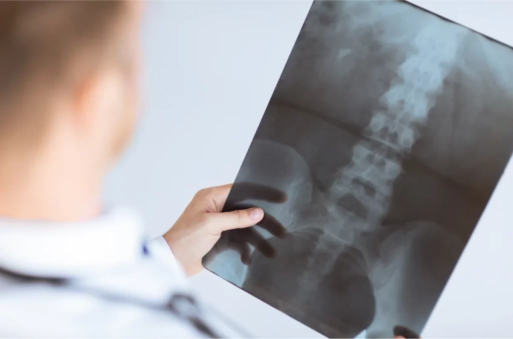 Minimally Invasive Spine treatment in chennai - overview