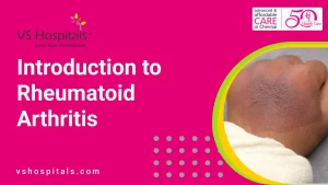 Introduction to Rheumatoid Arthritis