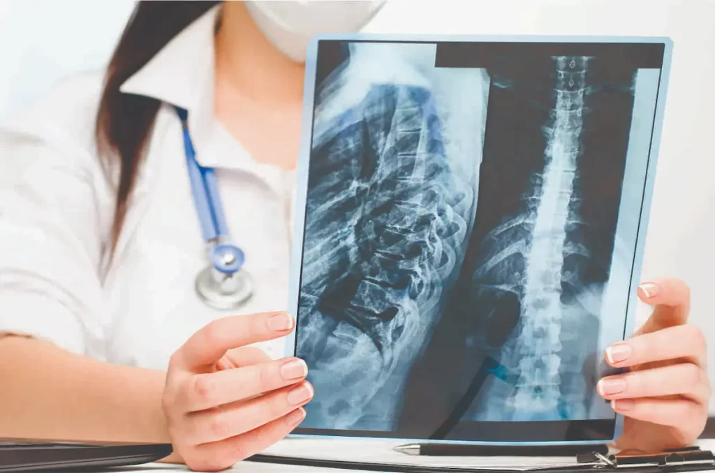 Spinal Decompression in Chennai