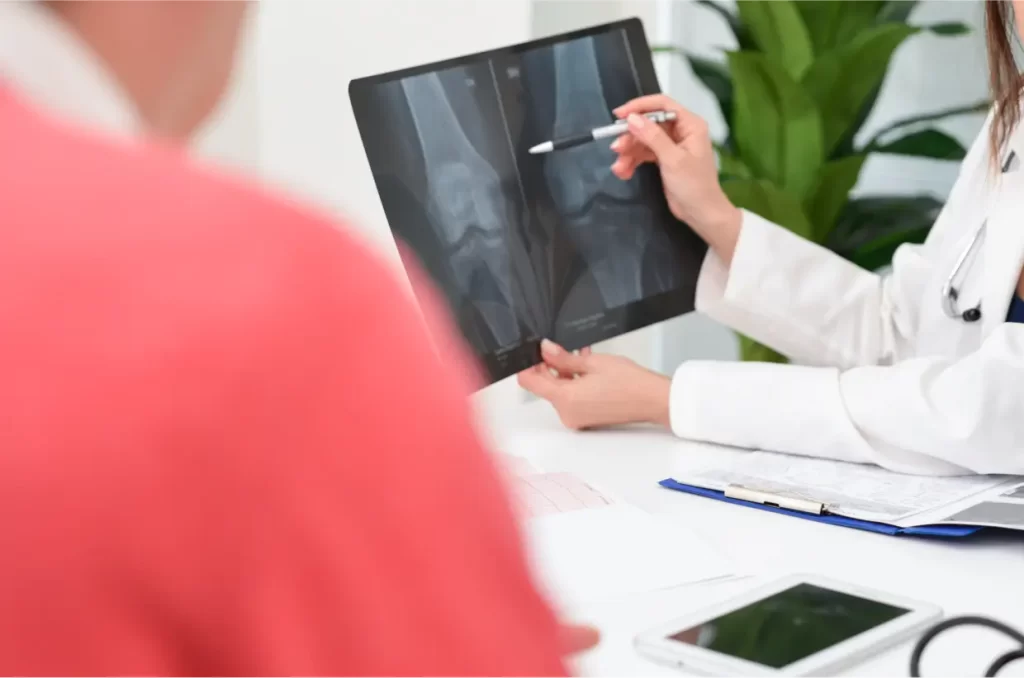 ACL Reconstruction treatment in chennai overview