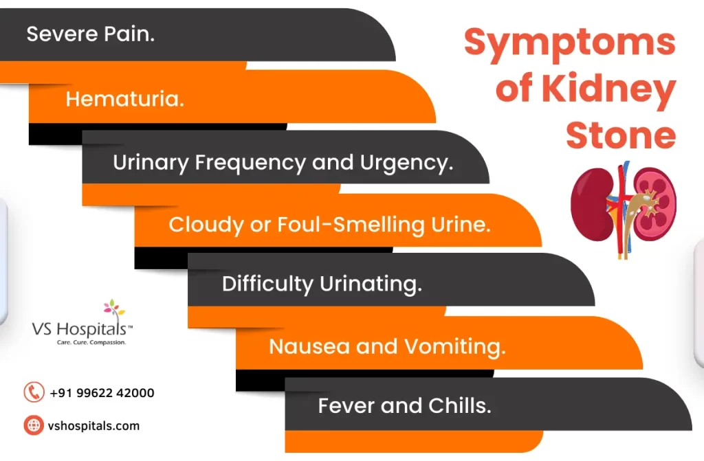 Best Kidney Stone Hospital in Chennai | VS Hospitals