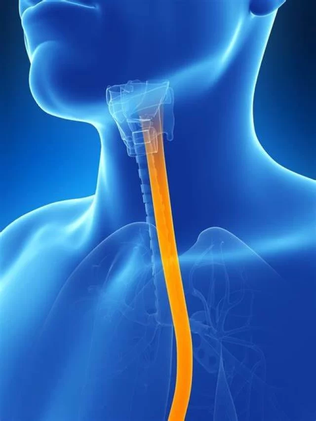 Early Symptoms of Esophageal Cancer | VS Hospitals