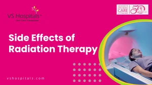 Side Effects of Radiation Therapy