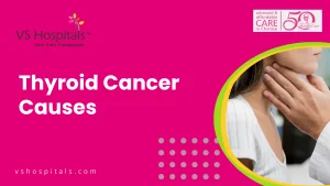Thyroid Cancer Causes