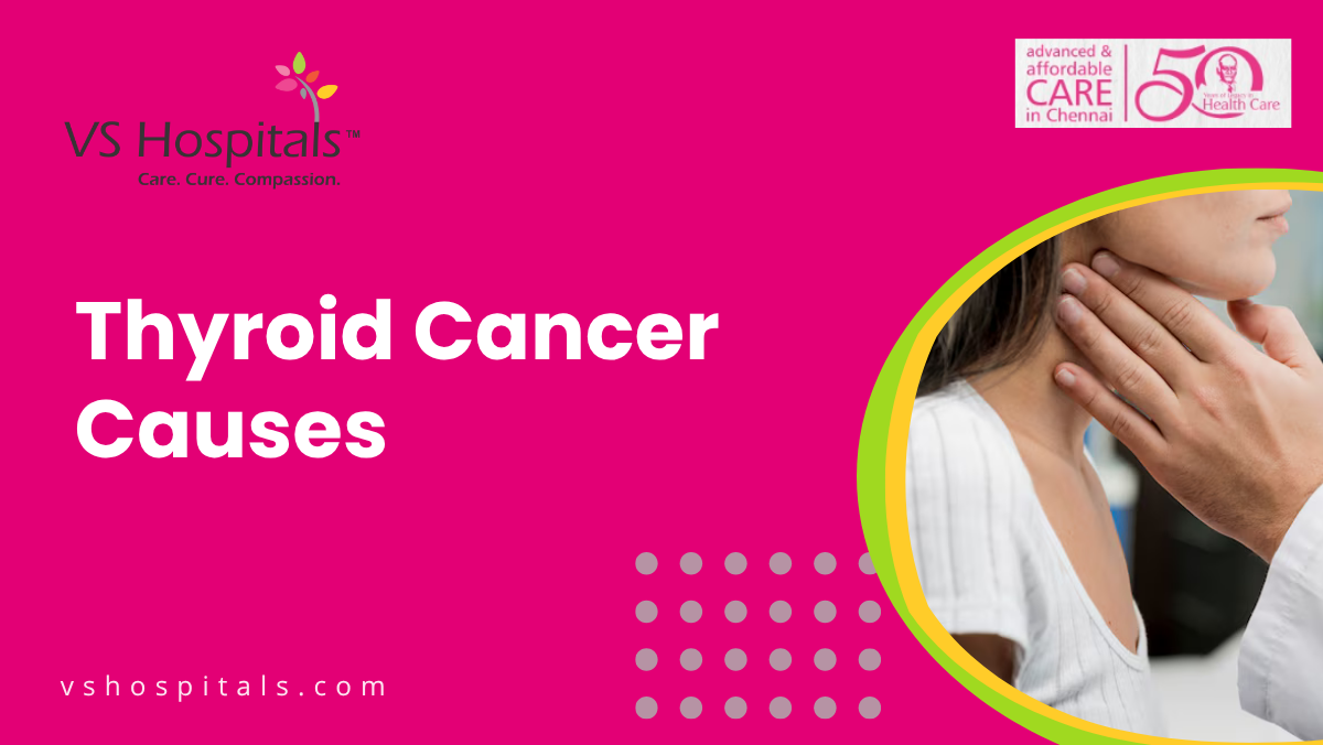 Thyroid Cancer Causes