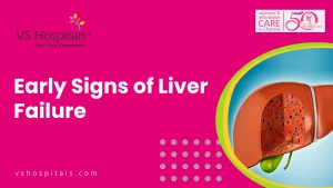 Early Signs Of Liver Failure