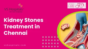 Kidney Stones Treatment In Chennai