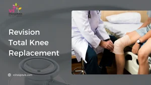 Revision Total Knee Replacement