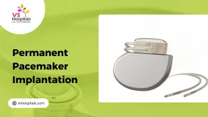 Permanent Pacemaker Implantation