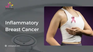 Inflammatory Breast Cancer