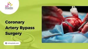 Coronary Artery Bypass Surgery