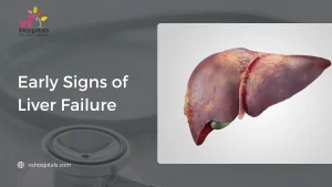 early signs of liver failure