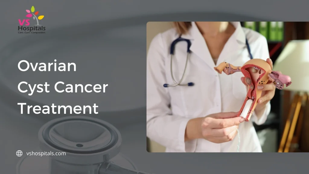 ovarian cyst cancer treatment