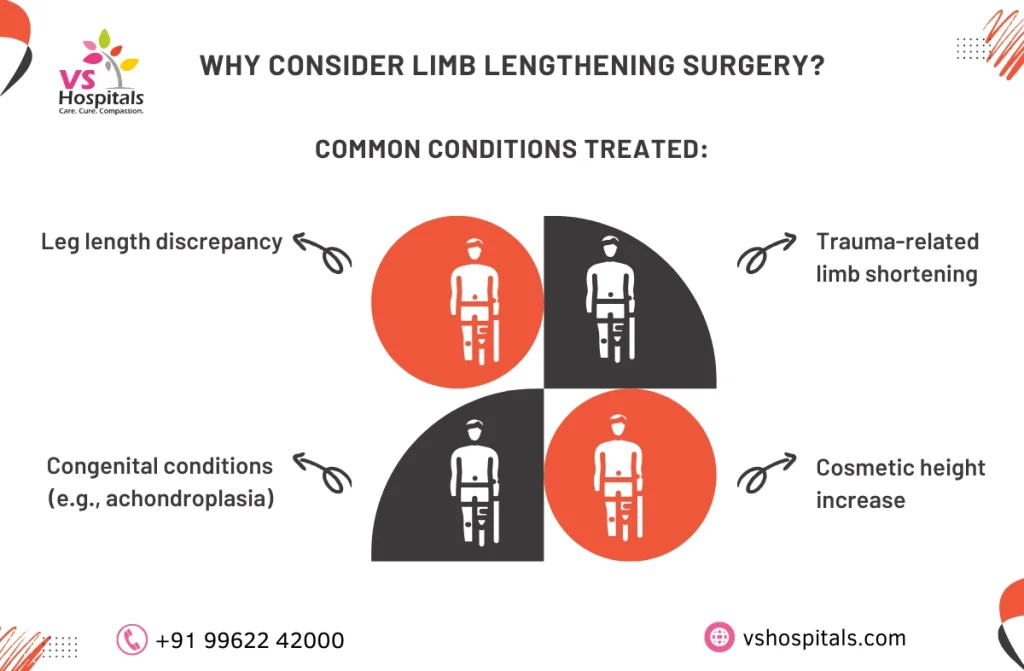 Limb Lengthening Surgery in Chennai