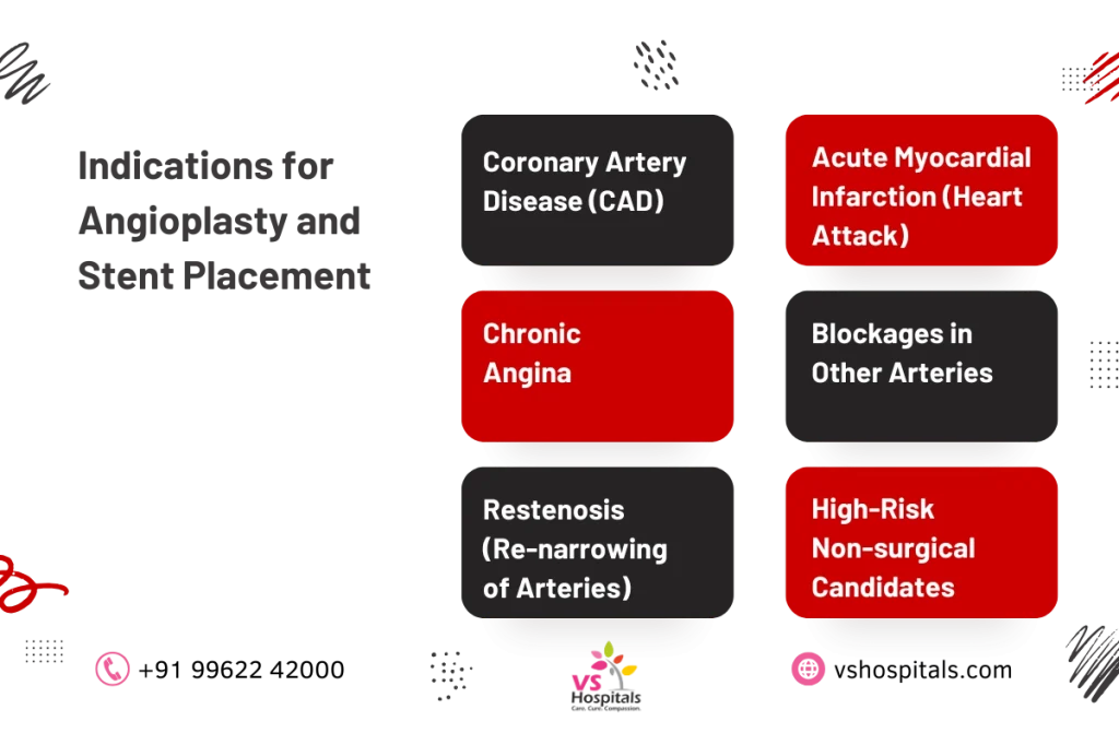 angioplasty and stent placement