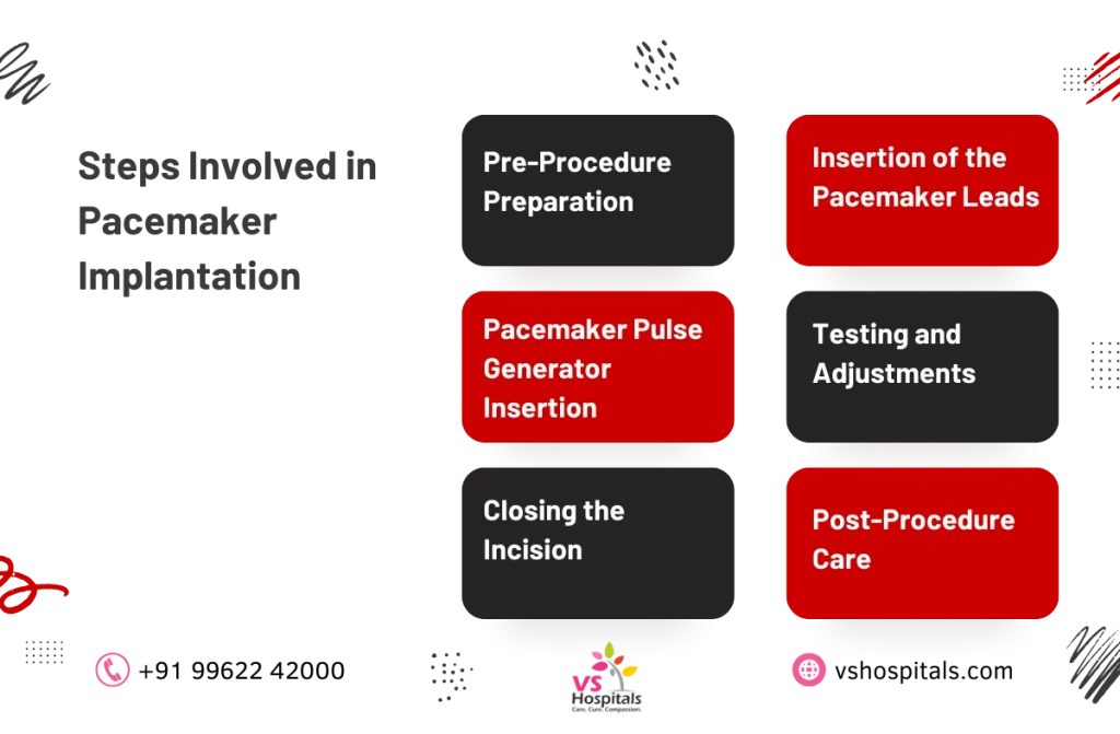 Permanent Pacemaker Implantation
