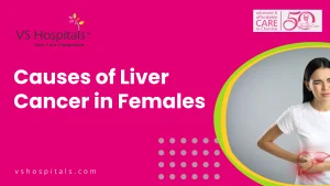 Causes of Liver Cancer in Females