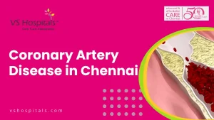 Coronary Artery Disease in Chennai