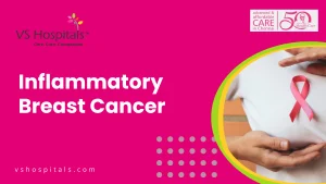 Inflammatory Breast Cancer