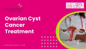 Ovarian Cyst Cancer Treatment