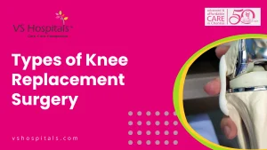 Types of Knee Replacement Surgery
