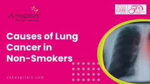 Causes of Lung Cancer in Non-Smokers