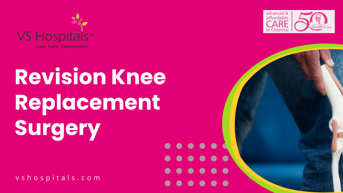 Revision Knee Replacement Surgery