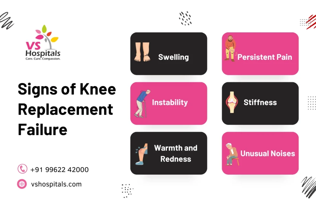 Revision knee replacement surgery