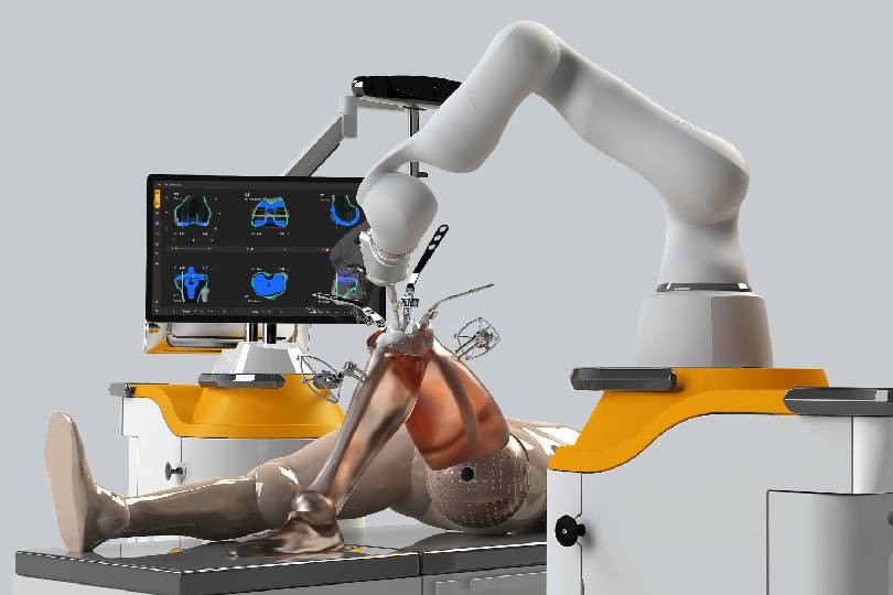 Robotic Joint Replacement1