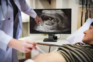 Ultrasound