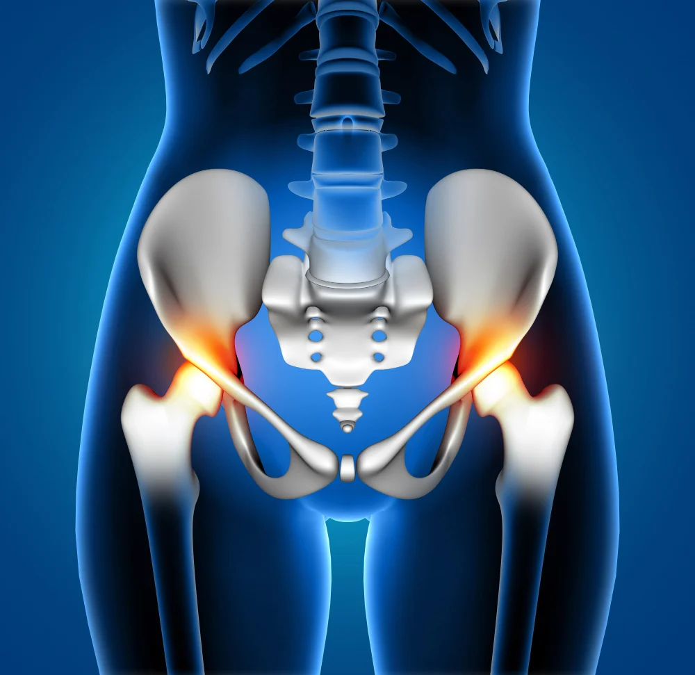 Best Partial Hip Replacement Surgery hospital in Chennai OVERVIEW