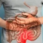 bladder cancer 1
