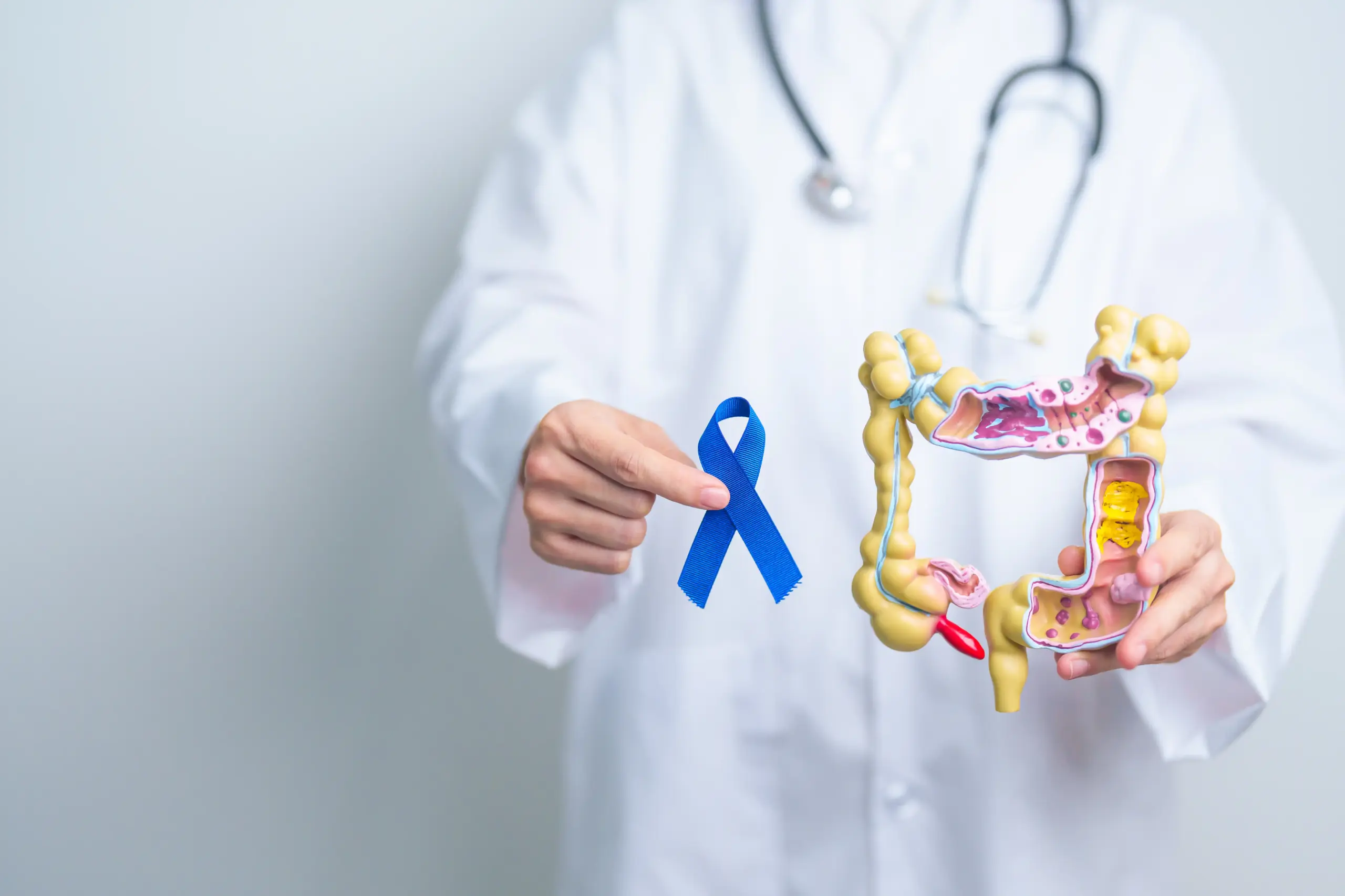 colorectal cancer