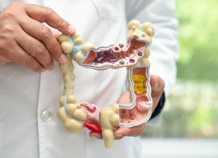 Tumors of the GI Tract