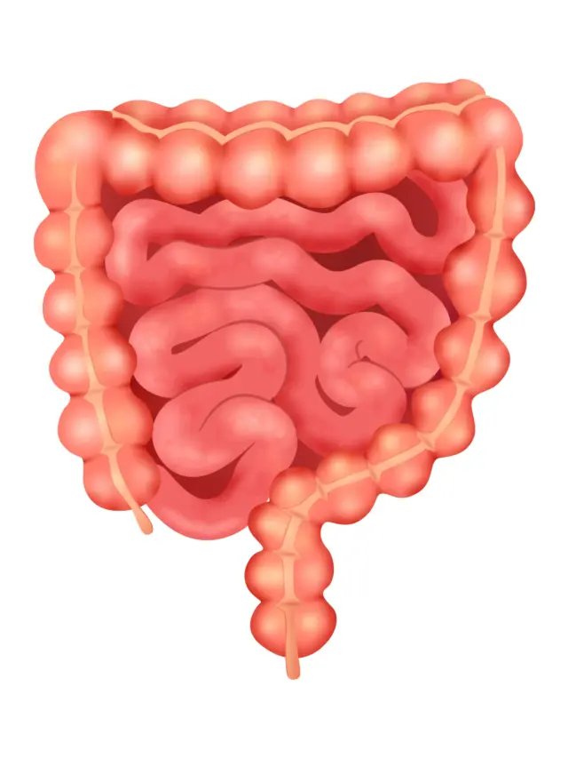 Irritable Bowel Syndrome