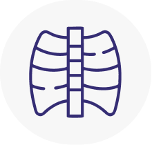 X-Ray