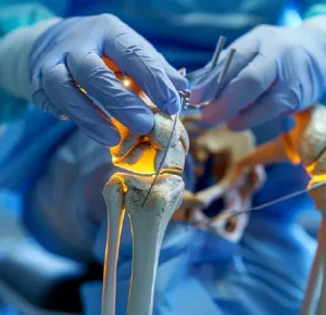 Surgical Oncology