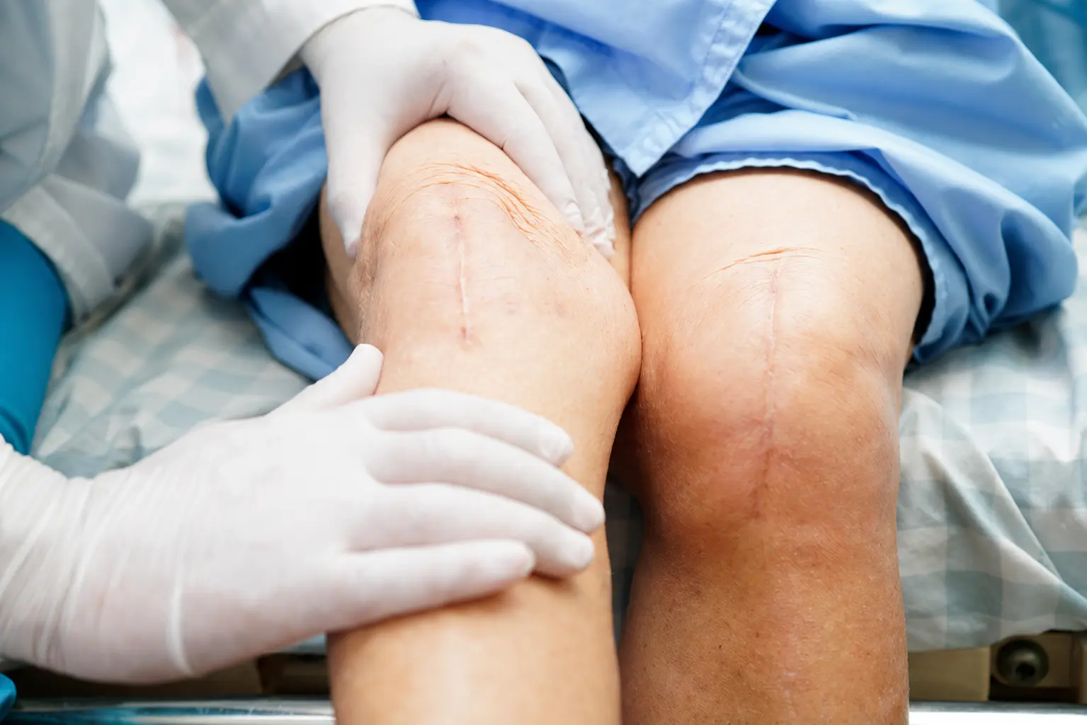 Knee Replacement Surgery