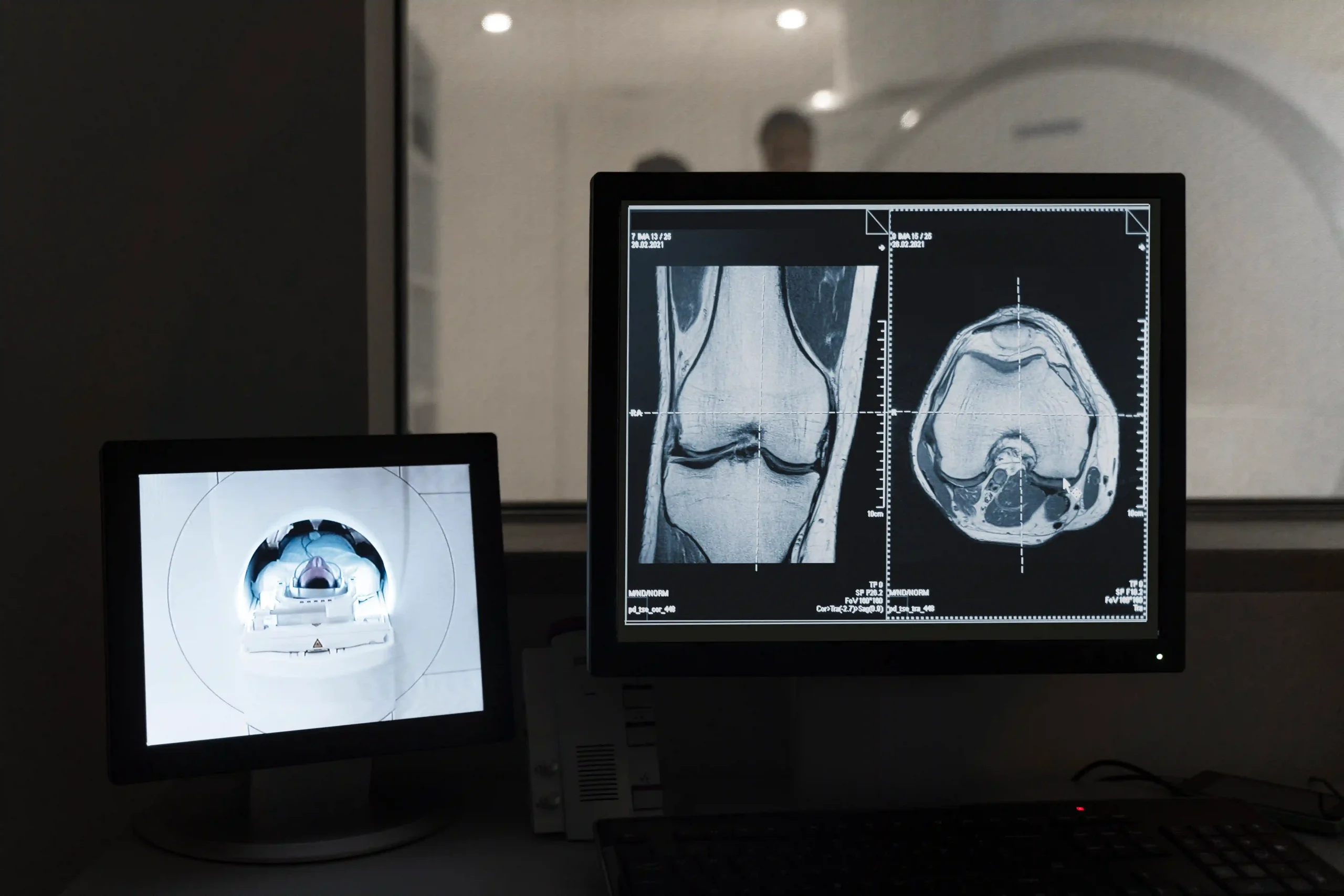 Knee Replacement Surgery