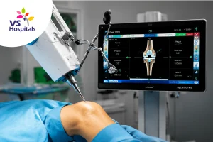 Robotic Knee Replacement Surgery