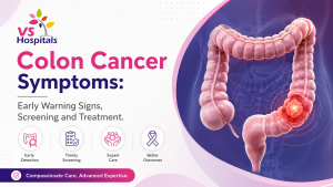Colon Cancer Symptoms